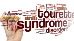 Deep Brain Stimulation e Sindrome di Tourette un nuovo metodo di cura